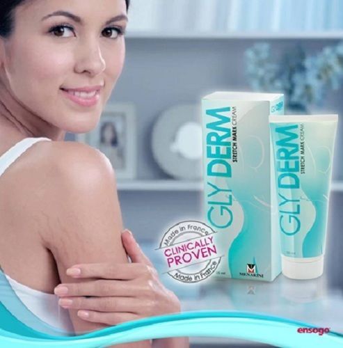 glyderm stretch mark