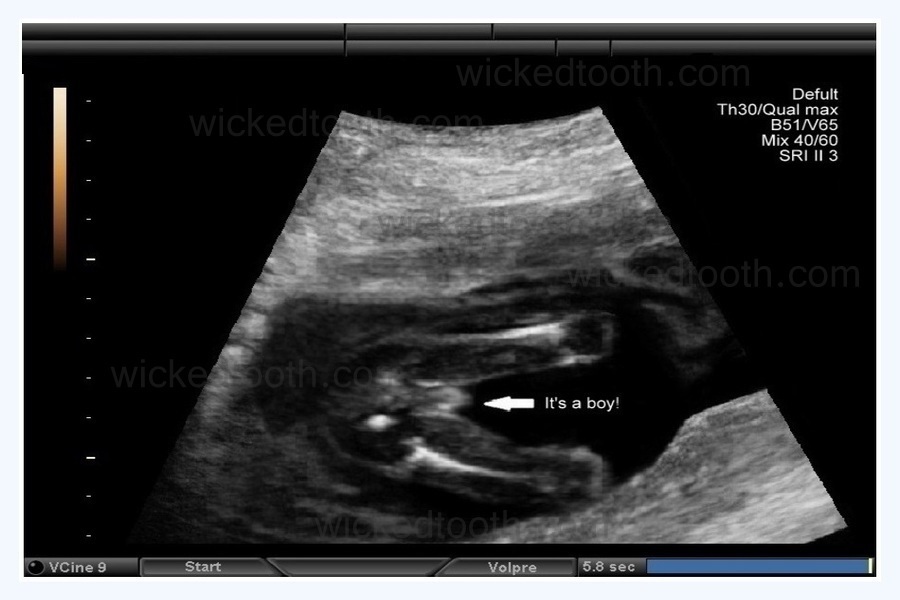 17 week 4d ultrasound pictures