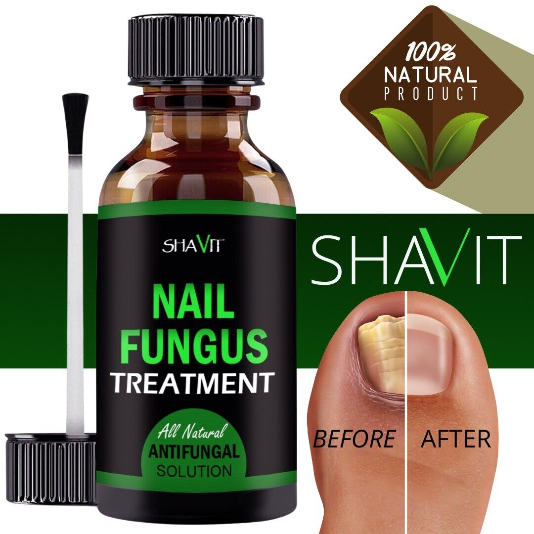 ANTI FUNGAL TREATMENT EXTRA STRENGTH TOENAIL FUNGUS ATHLETES FOOT FUNGI