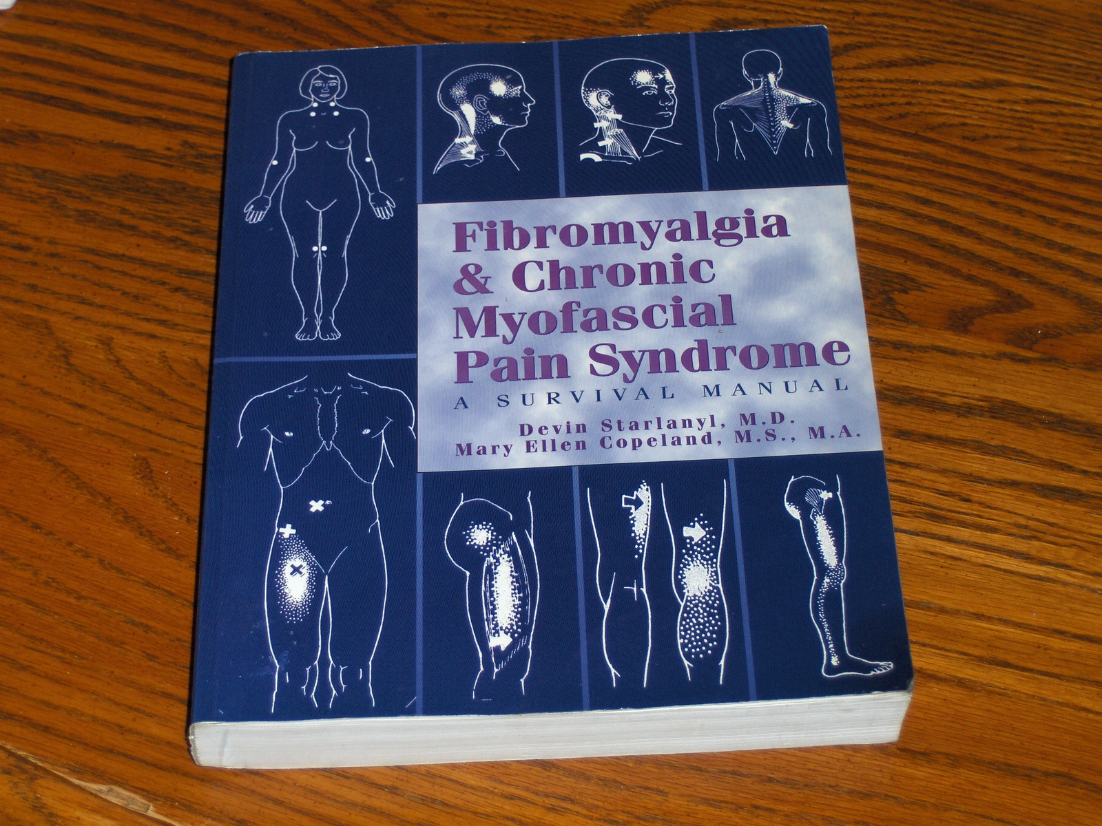 A Five Step Process For Managing Chronic Myofascial P vrogue.co