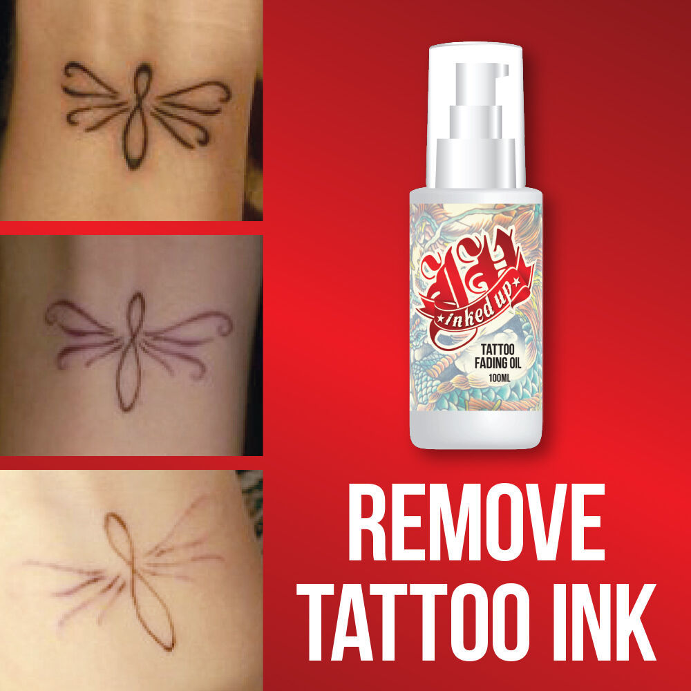 INKED UP TATTOO REMOVAL CREAM – NO NEED FOR LASER REMOVAL MAX STRENGTH |  eBay