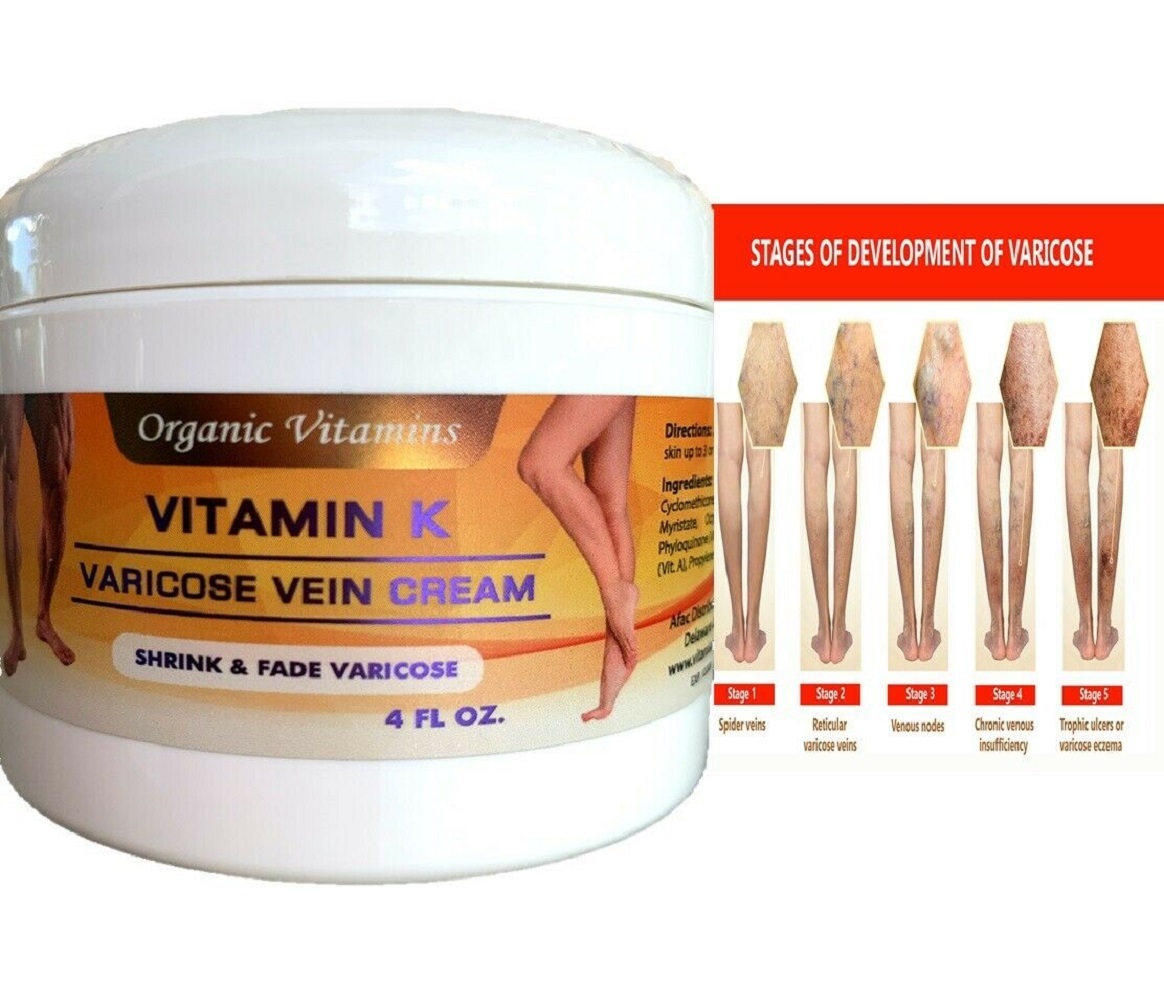 2 BOTTLES VITAMIN K CREAM VARICOSE VEIN SCAR ROSACEA CAPILLARIES RELIEF
