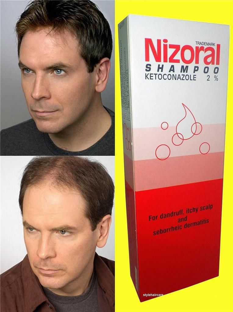 Ketoconazole Shampoo 2 Hair Growth