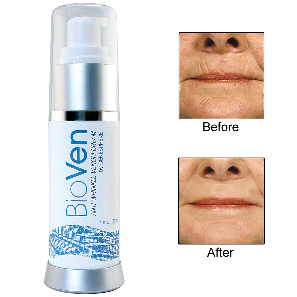 bioven anti wrinkle venom cream отзывы bioven anti wrinkle venom cream отзывы