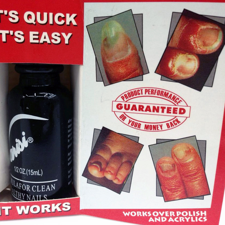 ANTIFUNGAL FUNGAL LOTION FINGER NAIL CARE CLEAN FUNGUS CUREV Other