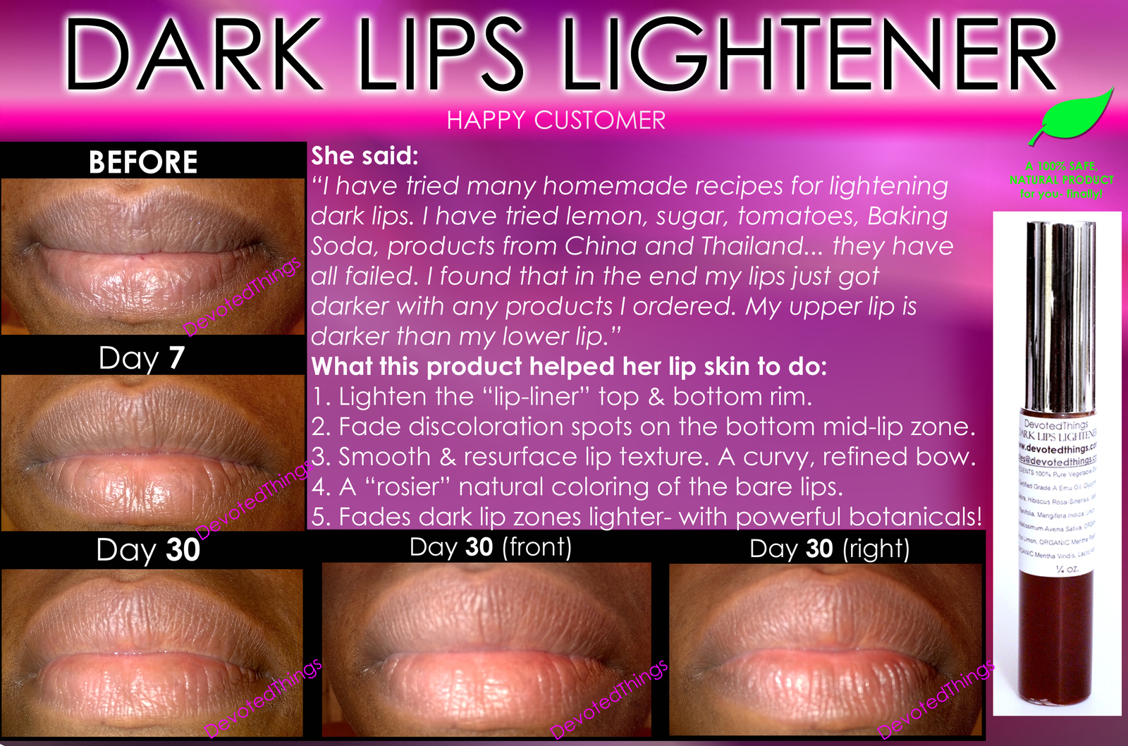 Best Dark Lip Lightening Natural Product Whitening Treatment To Get