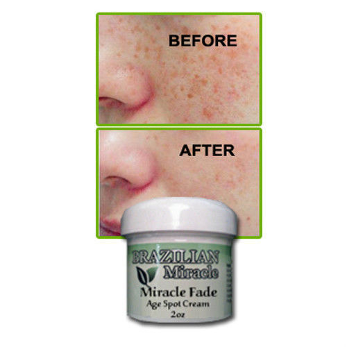 Anal Bleaching Cream All Botanical Made In The USA all natural **FREE