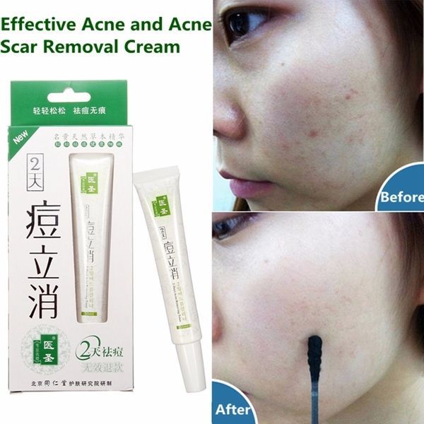 ACNE TREATMENT CREAM REMOVE BLEMISHES SUPER PRODUCT AMAZING