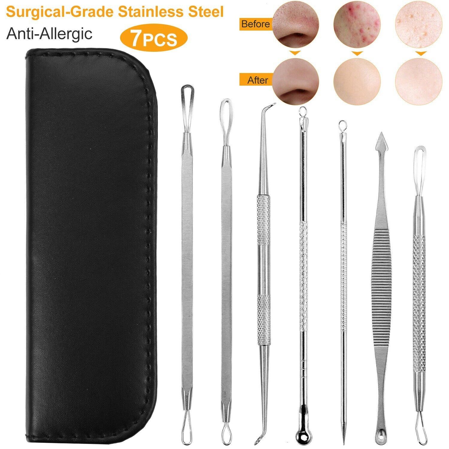 7Pcs Blackhead Acne Comedone Pimple Blemish Extractor Remover
