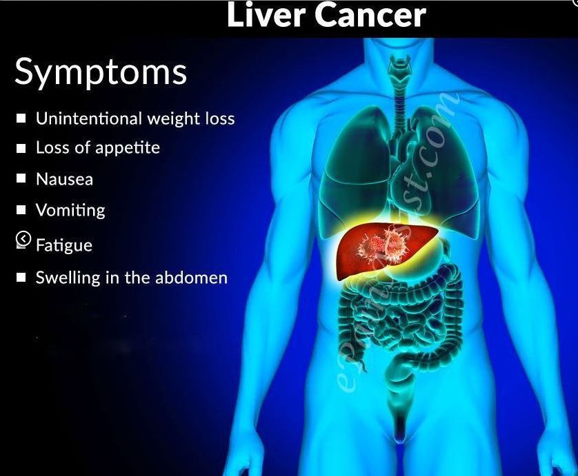 AFP ( liver disease / cancer ) + CEA ( cancers ) + PSA ( prostate ...