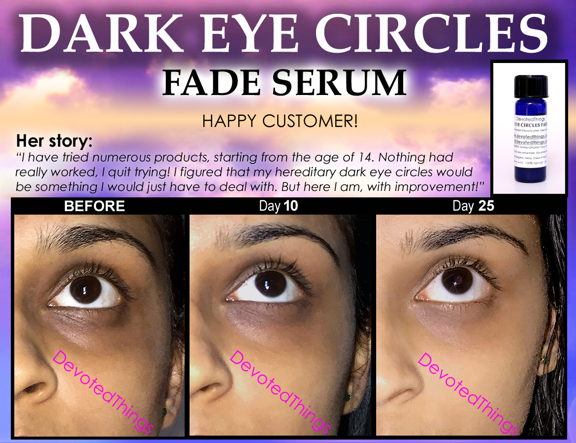 Natural Dark Circles Eye Treatment for Lightening Eyelids and Bags Fade