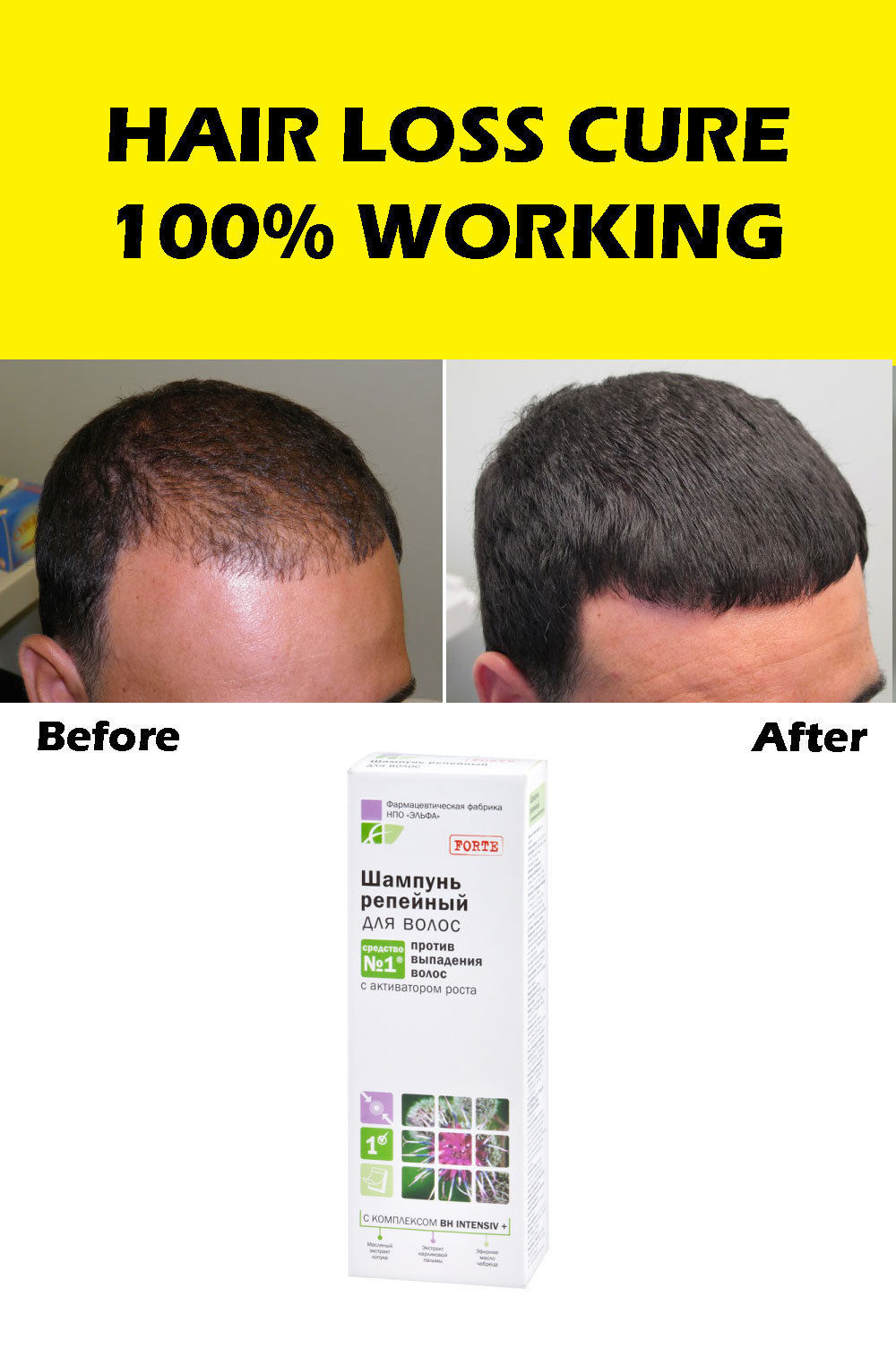 100 WORKS 5x Anti Hair Loss Scalp Treatment INSTANT