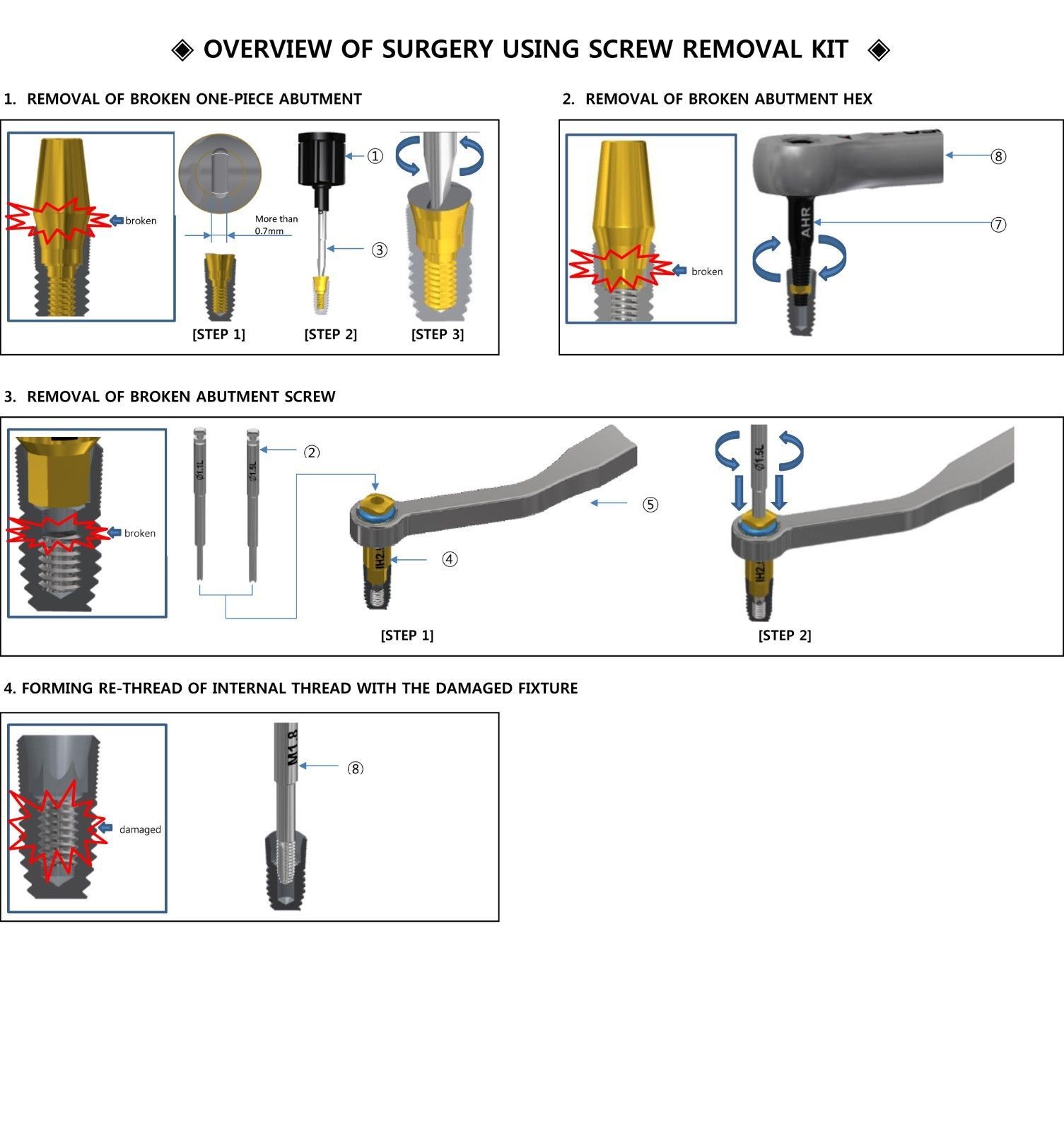 dental implants broken screw removal kit MIS 3I biomet zimmer