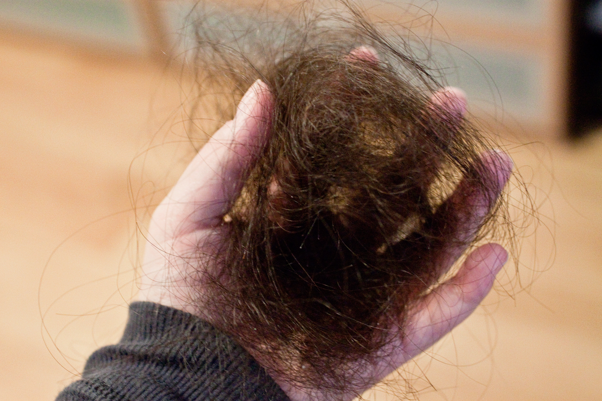 Hair Loss Curse And 31 Similar Items