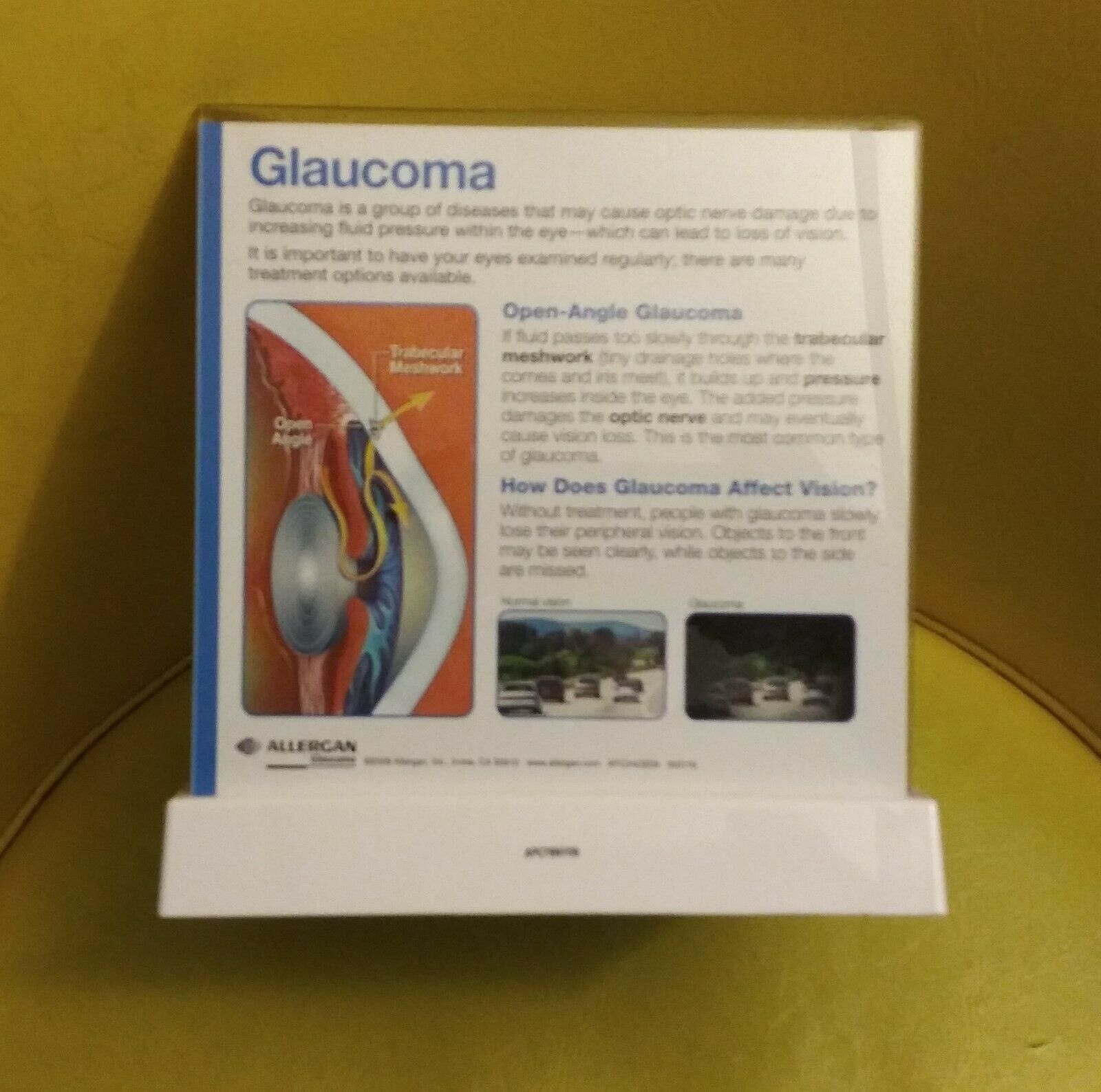 Allergan Display Right Eye Cross Section Anatomical Model