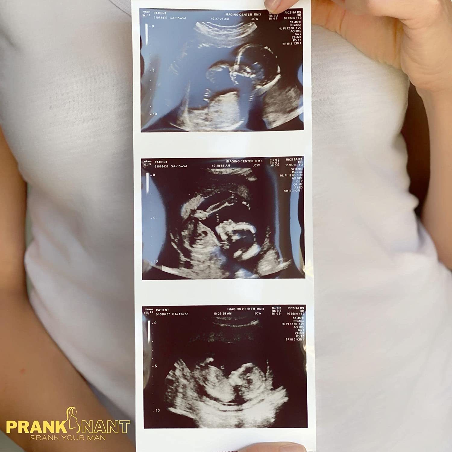 Fake Ultrasound Prank - auh7jlr