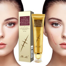 TCM Acne Scar Removal Cream Skin Repair Face Acne Treatment  Stretch Marks - $14.95