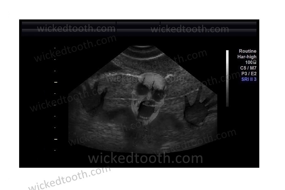 Spooky Halloween Ultrasound Gag