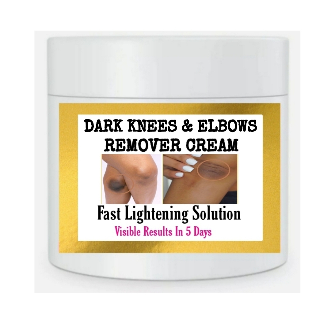 Dark knees and elbows eraser cream, dark spots remover cream