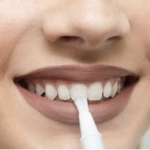 Avistar Professional Teeth Whitening Gel Pen 3 Pack Mint Flavour Natural... - $5.57