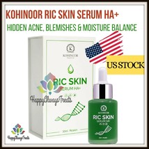 Ric Skin Serum HA+ Hidden Acne Treatment Fade Blemishes Melasma Moisture... - $52.80