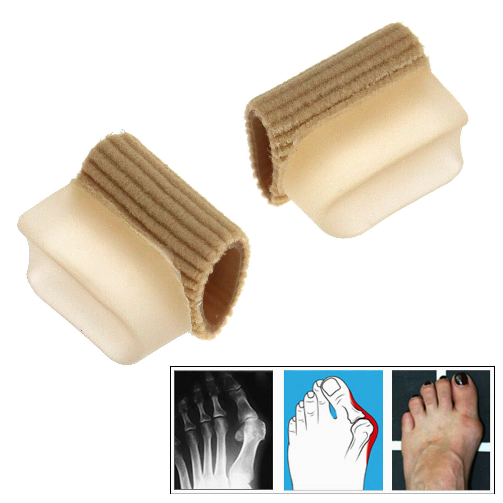 toe protection after surgery toe protection after surgery