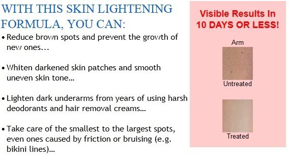 100% SAFE VAGINA GENITALIA ANUS SKIN LIGHTENING BLEACHING CREAM ...