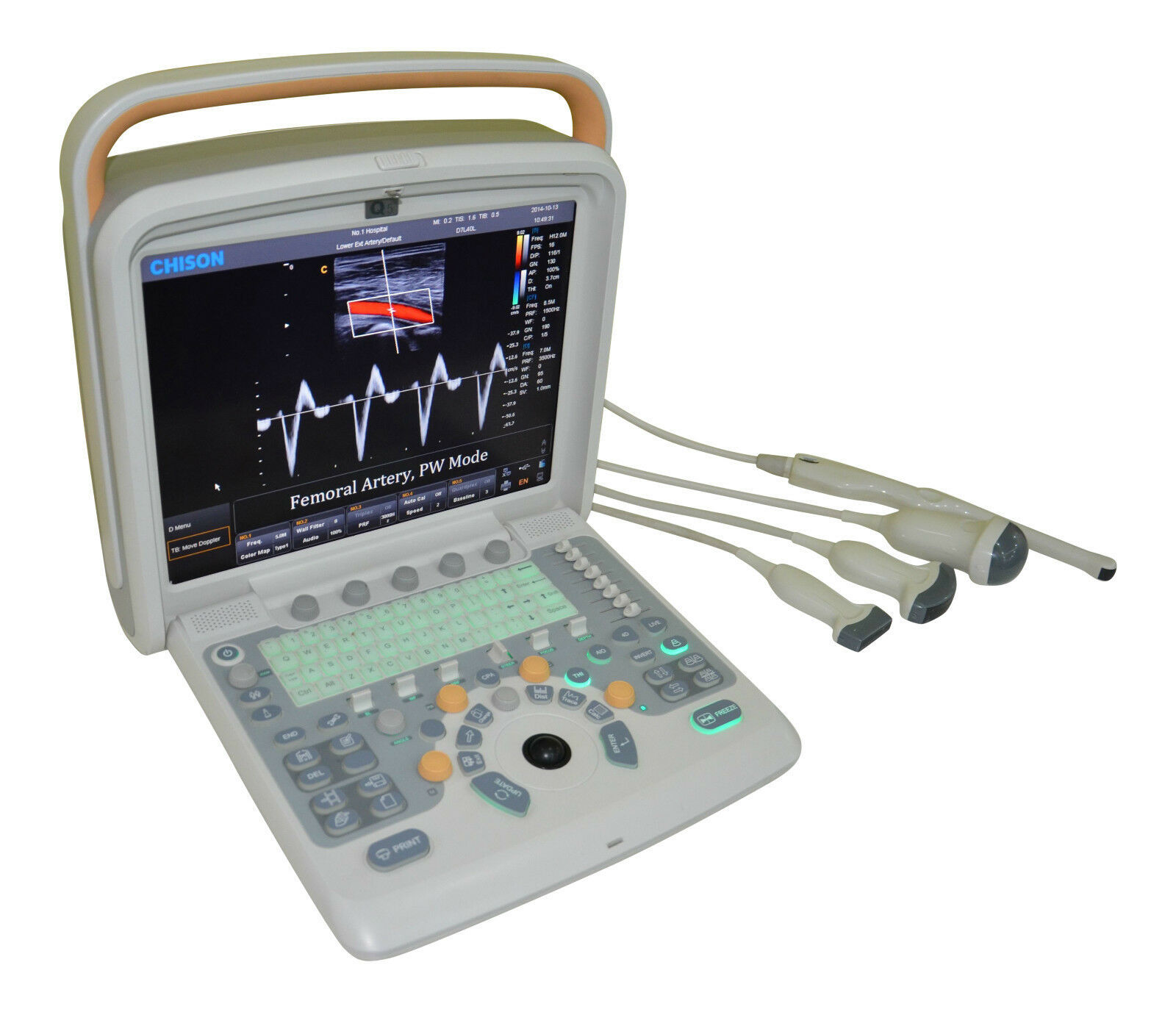 Color Doppler Ultrasound Scanner & Two probes Convex&Linear Probe ...