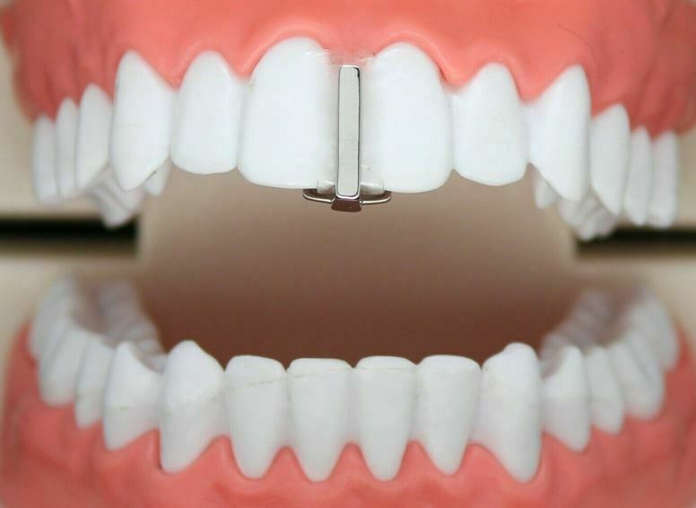 Custom Real Metal Silver Teeth Tooth Upper Top or Lower Gap Grillz with