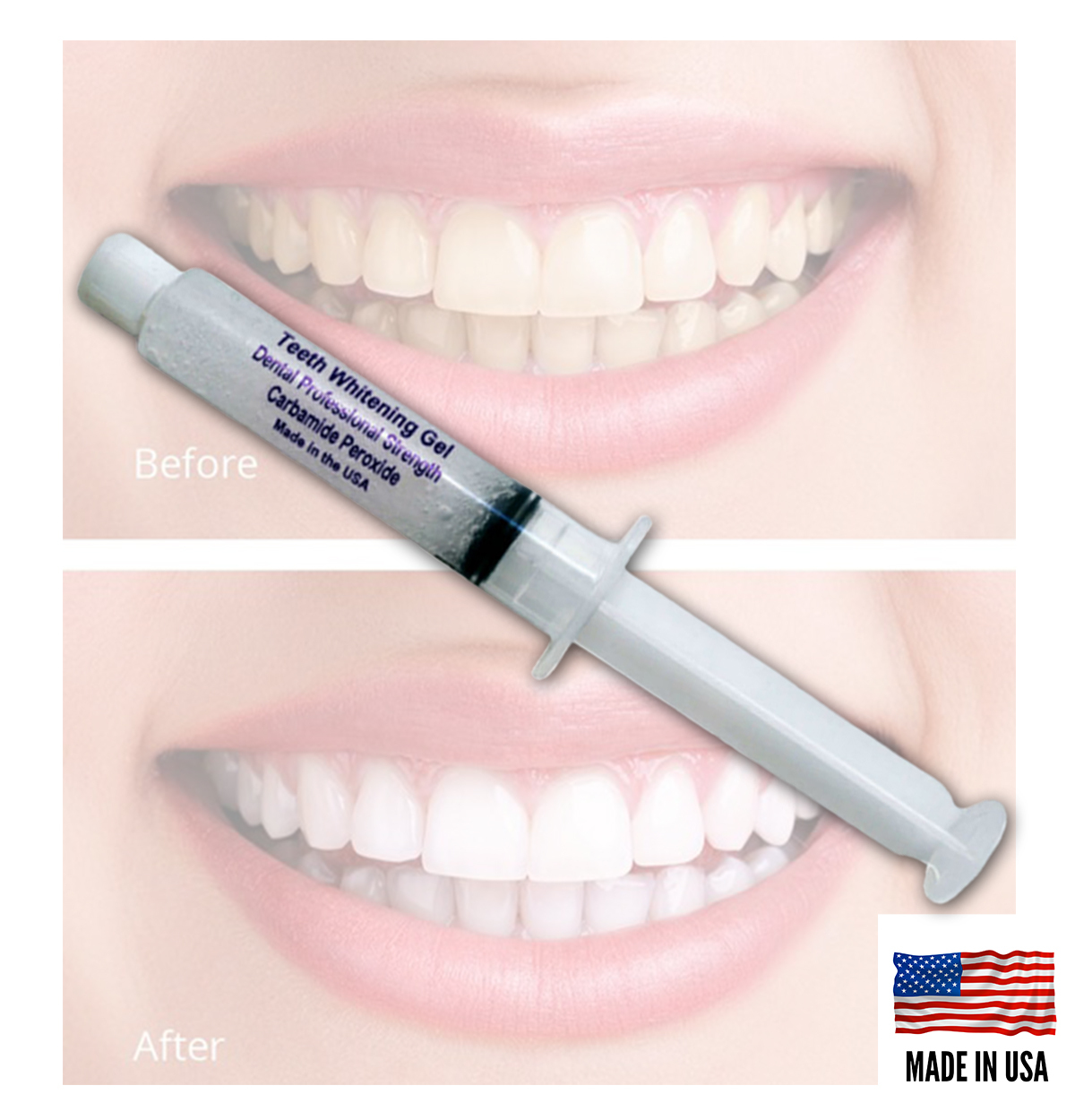 Always White Teeth Whitening Strongest Bleaching Kit Gel 44 At Home System USA Whitening