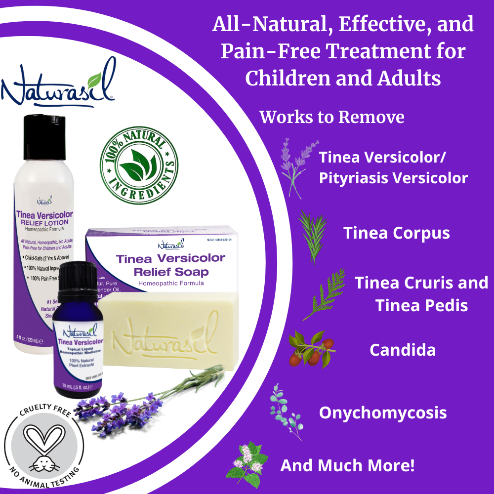 Tinea Versicolor Treatment Kit 4oz. Soap and 4oz. Lotion Homeopathic