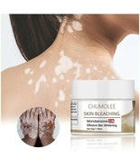 Dark Knuckles Remover Eraser Whitening Cream Bleaching Vitiligo Clear Cr... - $24.74