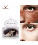 Crema Aclaradora Para Eliminar las Manchas y Arrugas de la Cara Blanquear - $14.95