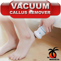 Electric Vacuum Foot File Callus Remover Dead Skin Grinder-USB Rechargeable - $18.99