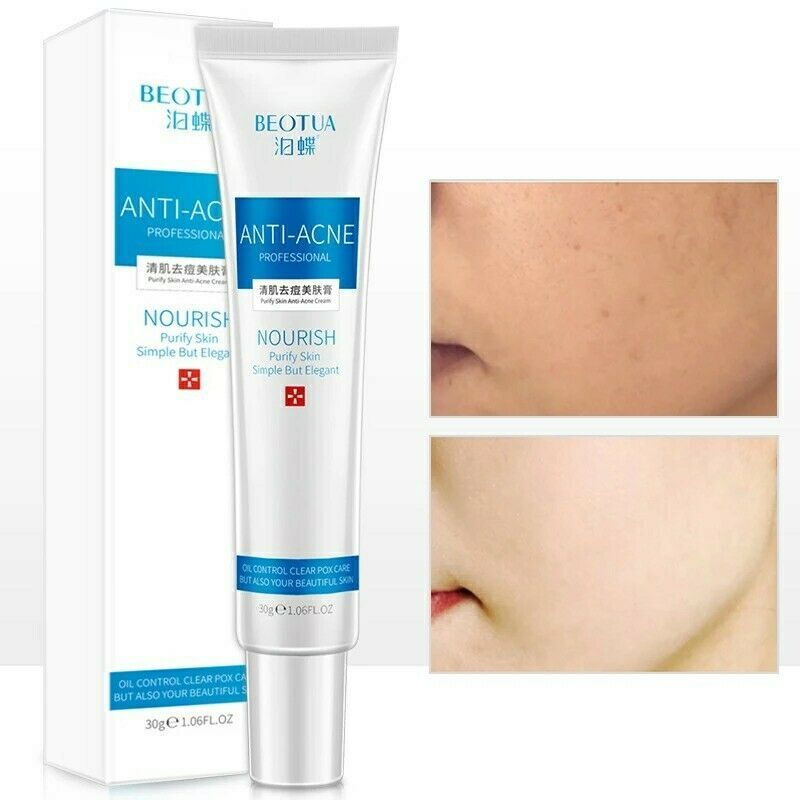 30g Face Care Gel Skin Care Face Cream Anti winkle Whitening Moisturizing Acne T