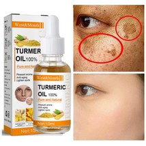 Turmeric Whitening Freckles Serum Remove Dark Spots  - $13.64
