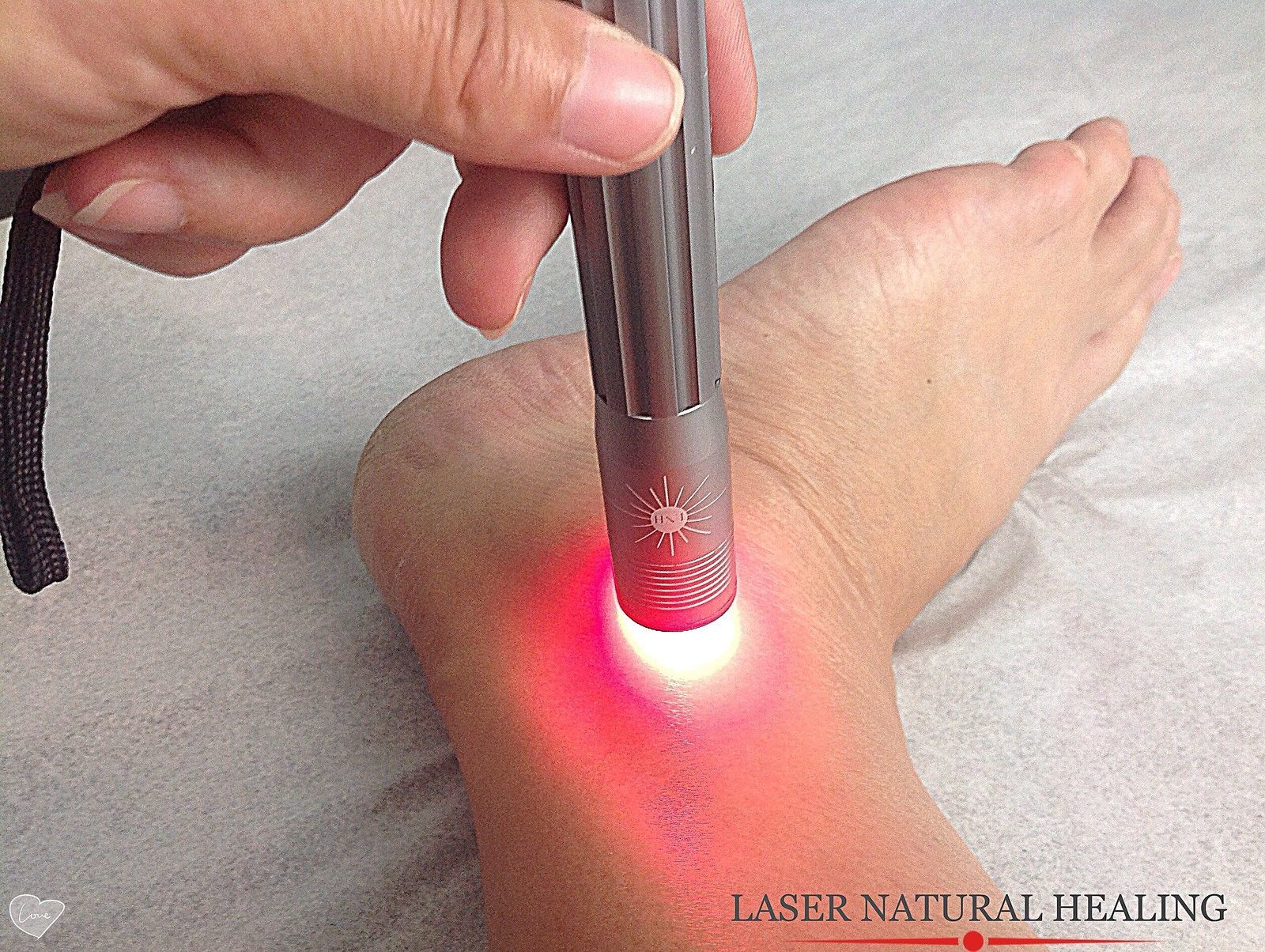 nail-fungus-removal-red-laser-photobiomodulation-kit-teatree-oil