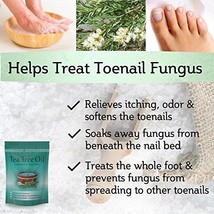 Tea Tree Oil Foot Soak Epsom Salt Treats Nail Fungus, Athletes Foot & Foot Odor - $34.99