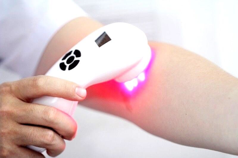 Plantar Fasciitis Therapy 3B, Medical Class, Red & Near Infrared Cold