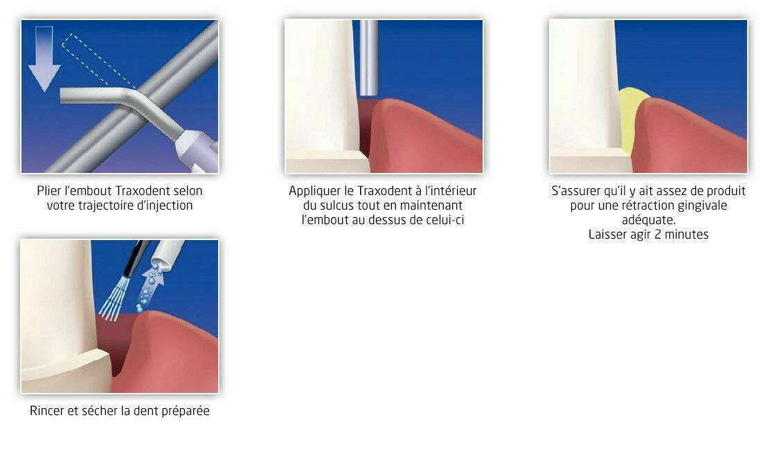 Traxodent by Premier Dental USA Hemodent Paste Retraction System Itena