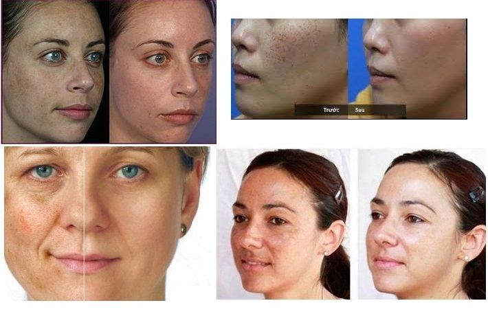 Skin lightening whitening Face Body cream brown pigmentary patches Sun damage - $4.11