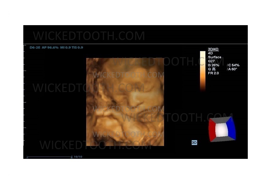 Prank 3D Fake Ultrasound Gag Gift Printable