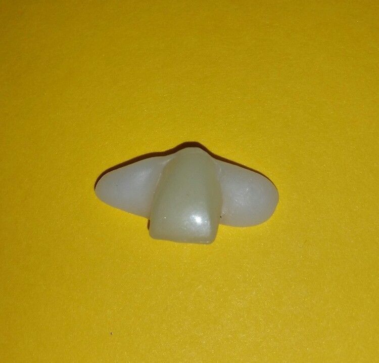 *DIY*Fake Tooth*New Temporary Replacement Front Tooth*Lateral Incisor
