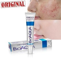 Face Cream Whitening Skin Care Anti Acne Treatment Cream Oil Control Sca... - $9.99