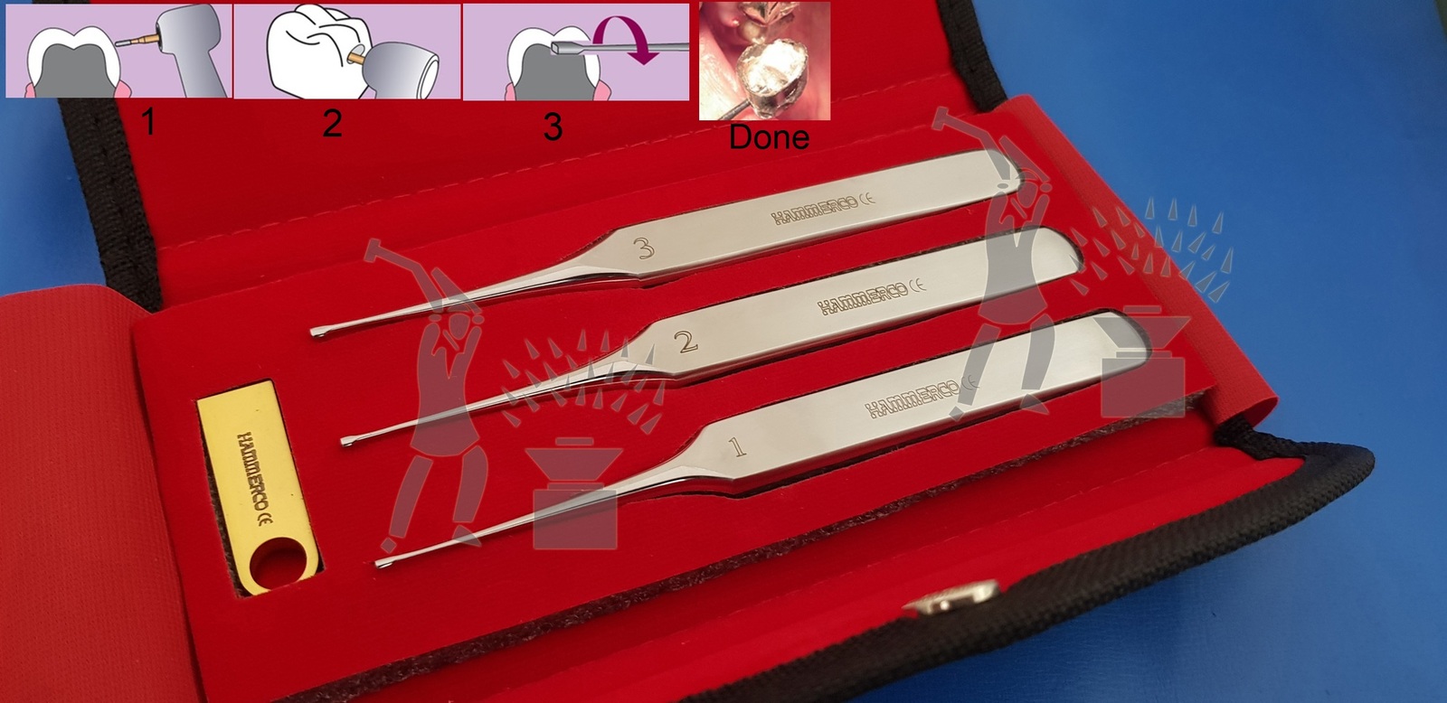 WAMkey Crown & Bridge Removal System, Dental Crown Remover, Dental