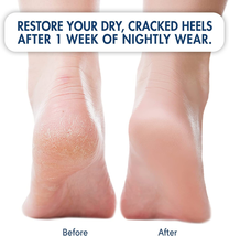 Dr. Frederick' Moisturizing Heel Socks for Cracked Heel Treatment - 2 Pairs - St image 2