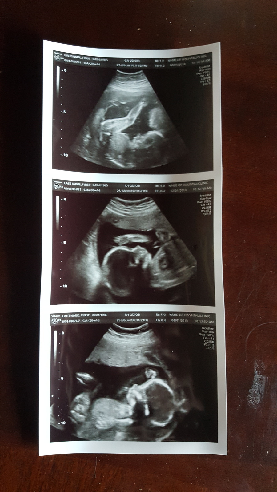 REAL US PAPER Fake Prank Gag Custom Positive Pregnancy 2D Ultrasound ...