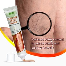  Chinese herbs -lot 3 pcs cream for the people vasculitis and varicose veins  - $16.00