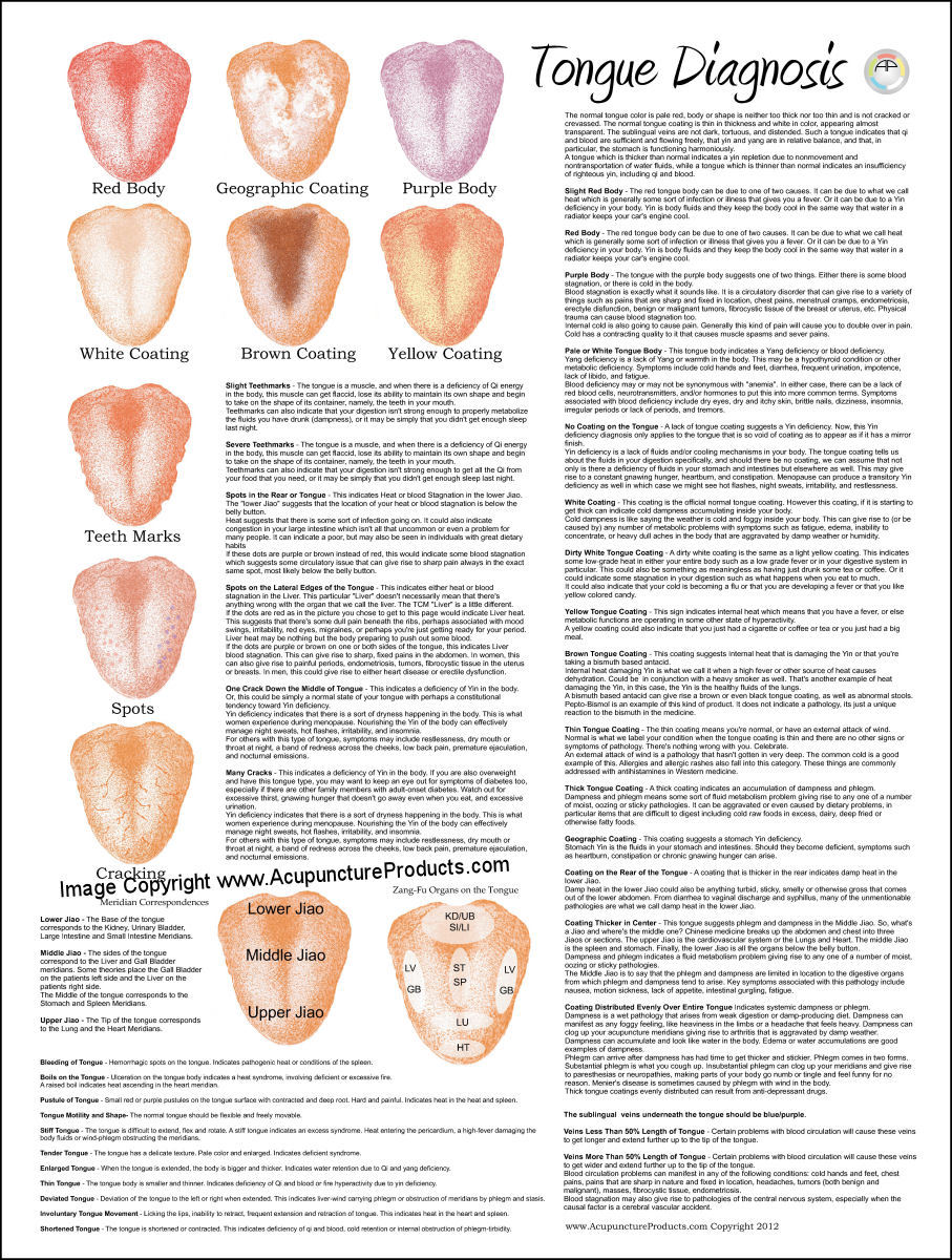 Tongue Diagnosis Acupuncture Poster 18 X 24 and similar items