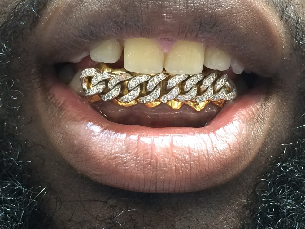 Show full-size image of 14k gold Overlay Removable gold teeth caps Grillz &...